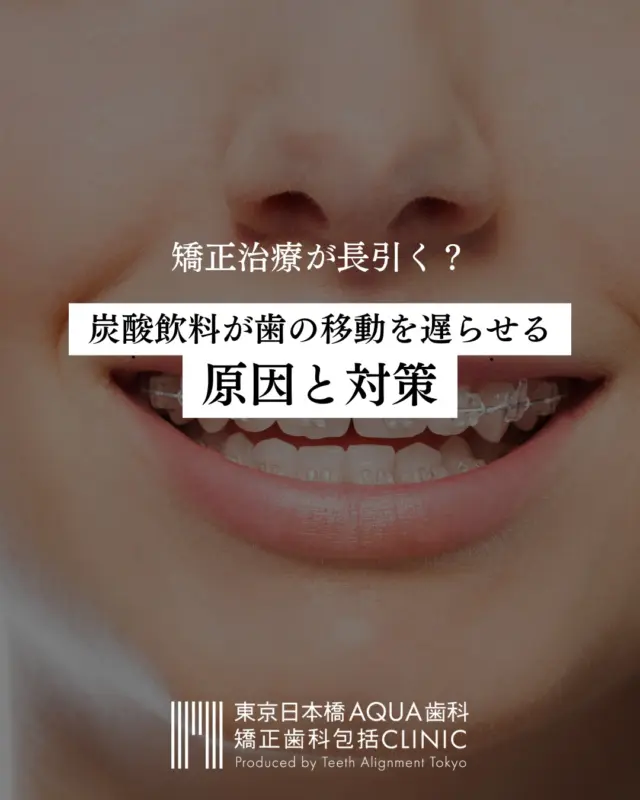 【矯正治療が長引く原因？】炭酸飲料との付き合い方について
.
矯正治療中、日々口にするものが歯や矯正装置に影響があるかについて関心が高い方も多いのでは？
.
炭酸飲料が歯の移動を遅らせる原因と対策をご紹介しました。
.
賢く付き合うコツを知って、快適な矯正ライフを送りましょう✨
.
 #歯科 #歯科医院 #歯科矯正 #包括的歯科治療 #矯正歯科 #矯正治療 #歯科医師 #歯科医 #包括的矯正歯科 #包括的矯正歯科治療 #包括的矯正歯科研究会 #矯正コース #矯正歯科コース #dentist #interdisciplinary #orthodontics #炭酸飲料 #炭酸飲料水 #炭酸飲料が好き