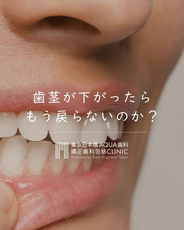 「歯茎が下がってきた気がする…」
そう気づいた時、もう手遅れなのでしょうか？

─────────────

結論からお伝えします。

一度下がった歯茎は
自然には戻りません。

「歯茎が下がってきた気がする…」
そのお悩み、諦めないでください。

進行を止めることも、
状態によっては回復を目指すことも
できる可能性があります。

まず知ることが、最初の一歩です。
気になる方はお気軽にご相談ください💭

プロフィールのリンクもしくは下記よりお問い合わせ可能です
🔗https://www.teeth-alignment.jp/appointment.html

フォローして次回の投稿もお待ちください✍🏻

#日本橋歯科 #歯肉退縮 #OPRO法 #歯周病治療 #包括的矯正治療